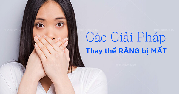 Các Giải Pháp Thay Thế Răng Bị Mất