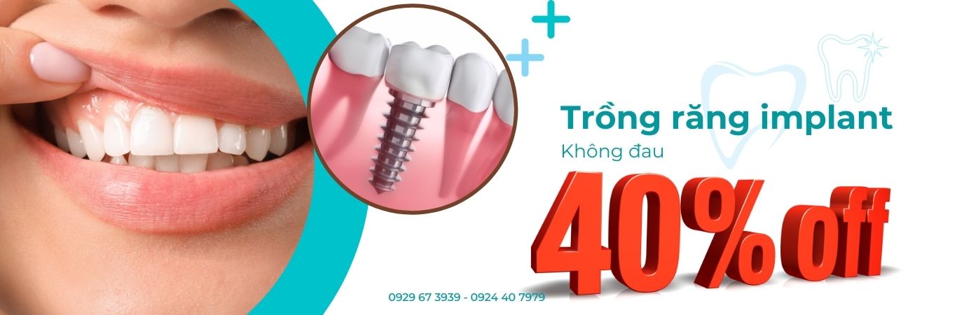 Trồng răng implant không đau